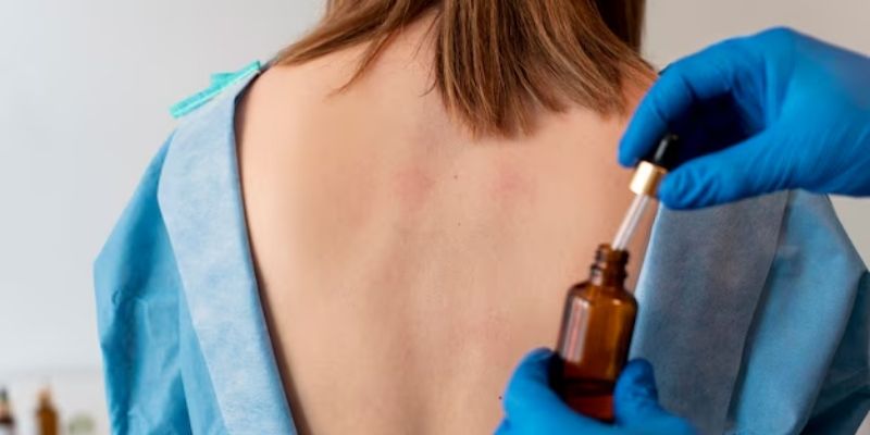 Why Azelaic Acid Might Be Your Secret Weapon Against Acne